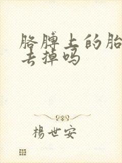 胳膊上的胎记能去掉吗