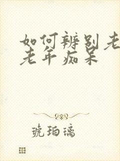 如何辨别老人装老年痴呆