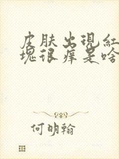 皮肤出现红色斑块很痒是啥原因