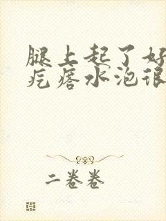 腿上起了好多红疙瘩水泡很痒