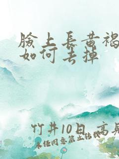 脸上长黄褐斑该如何去掉