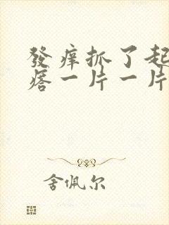 发痒抓了起红疙瘩一片一片的