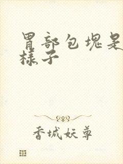 胃部包块是什么样子