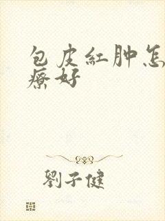 包皮红肿怎么治疗好