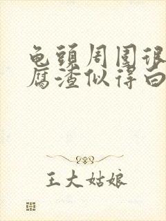 龟头周围很多豆腐渣似得白色分泌物