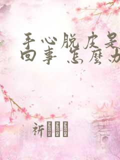 手心脱皮是怎么回事 怎么办