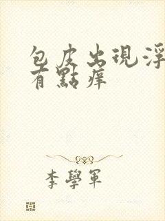 包皮出现浮肿还有点痒