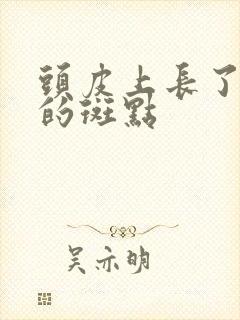 头皮上长了白色的斑点