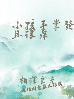 小孩手掌发红而且很痒