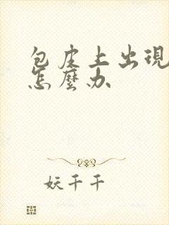 包皮上出现流脓怎么办