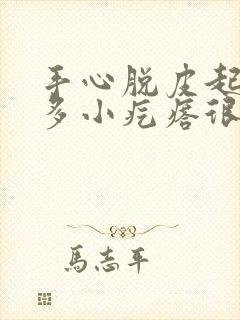 手心脱皮起了很多小疙瘩很痒怎么办