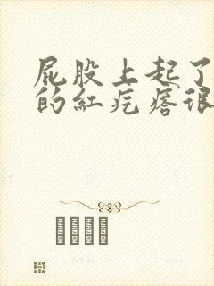 屁股上起了好多的红疙瘩很痒