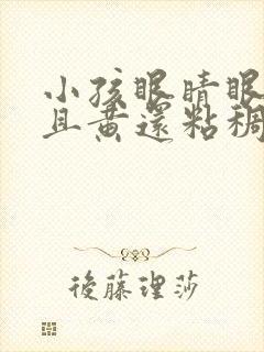 小孩眼睛眼屎多且黄还粘稠怎么办