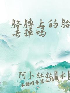 胳膊上的胎记能去掉吗