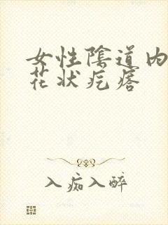 女性阴道内长菜花状疙瘩