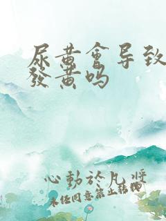 尿黄会导致内裤发黄吗