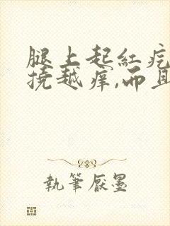 腿上起红疙瘩越挠越痒,而且一片一片