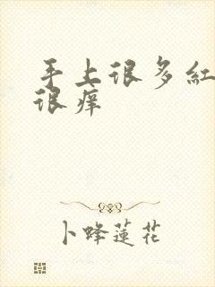 手上很多红点点很痒