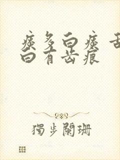 痰多白痰 舌苔白有齿痕