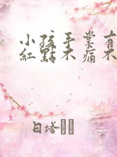 小孩手掌有很多红点不痛不痒