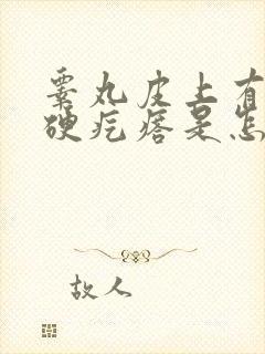 睾丸皮上有白色硬疙瘩是怎么回事