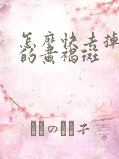 怎么快去掉脸上的黄褐斑