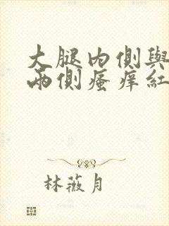 大腿内侧与阴囊两侧瘙痒红肿