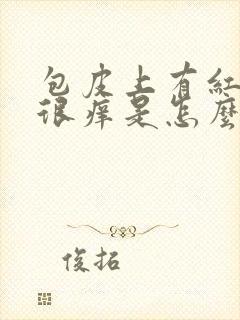 包皮上有红颗粒很痒是怎么回事