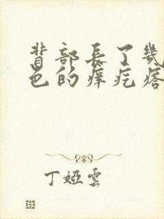 背部长了几个红色的痒疙瘩