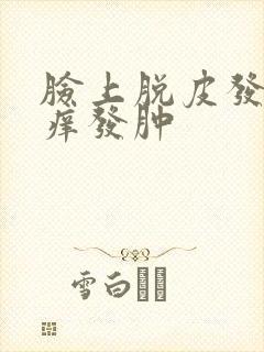 脸上脱皮发红发痒发肿