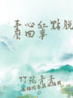 手心红点脱皮怎么回事