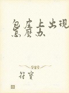 包皮上出现流脓怎么办