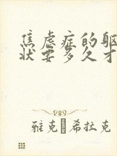 焦虑症的躯体症状要多久才能消失