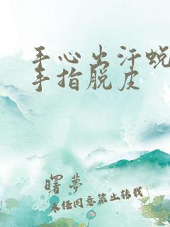 手心出汗蜕皮 手指脱皮