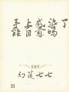 手上感染了脚气能自愈吗