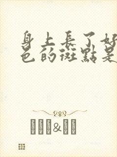 身上长了好多黑色的斑点是怎么回事