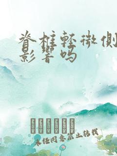 脊椎轻微侧弯有影响吗