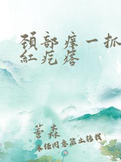 颈部痒一抓就起红疙瘩