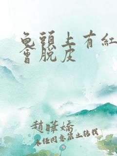 龟头上有红点还会脱皮