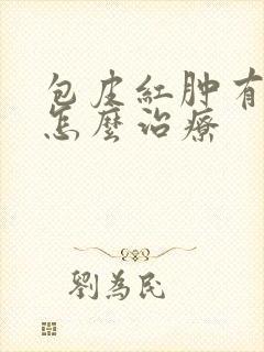 包皮红肿有点痒怎么治疗