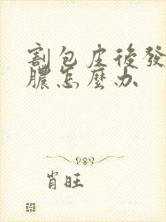 割包皮后发炎流脓怎么办