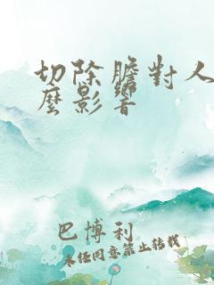 切除胆对人有什么影响