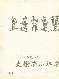 包皮和龟头红而且还痒是怎么回事