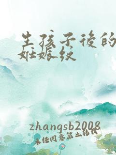 生孩子后的肚子妊娠纹