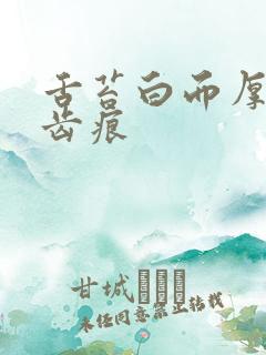 舌苔白而厚腻有齿痕