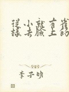 从小就有雀斑怎样去脸上的雀斑