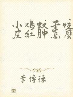 小鸡蚊子咬了眼皮红肿怎么办