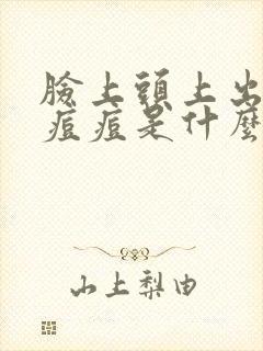 脸上头上出油长痘痘是什么原因