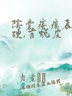 阴囊瘙痒表皮发硬,有蜕皮