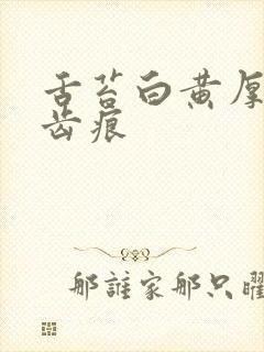 舌苔白黄厚腻有齿痕